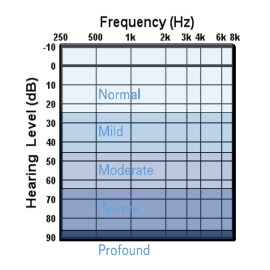 Abnormal Thresholds